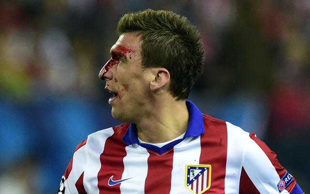Mandzukic