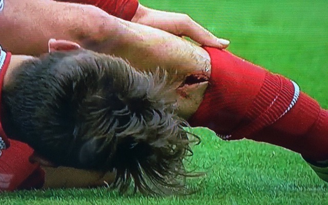 Gaston Ramirez gashled leg