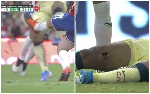 Horror-tackle-on-Dos-Santos