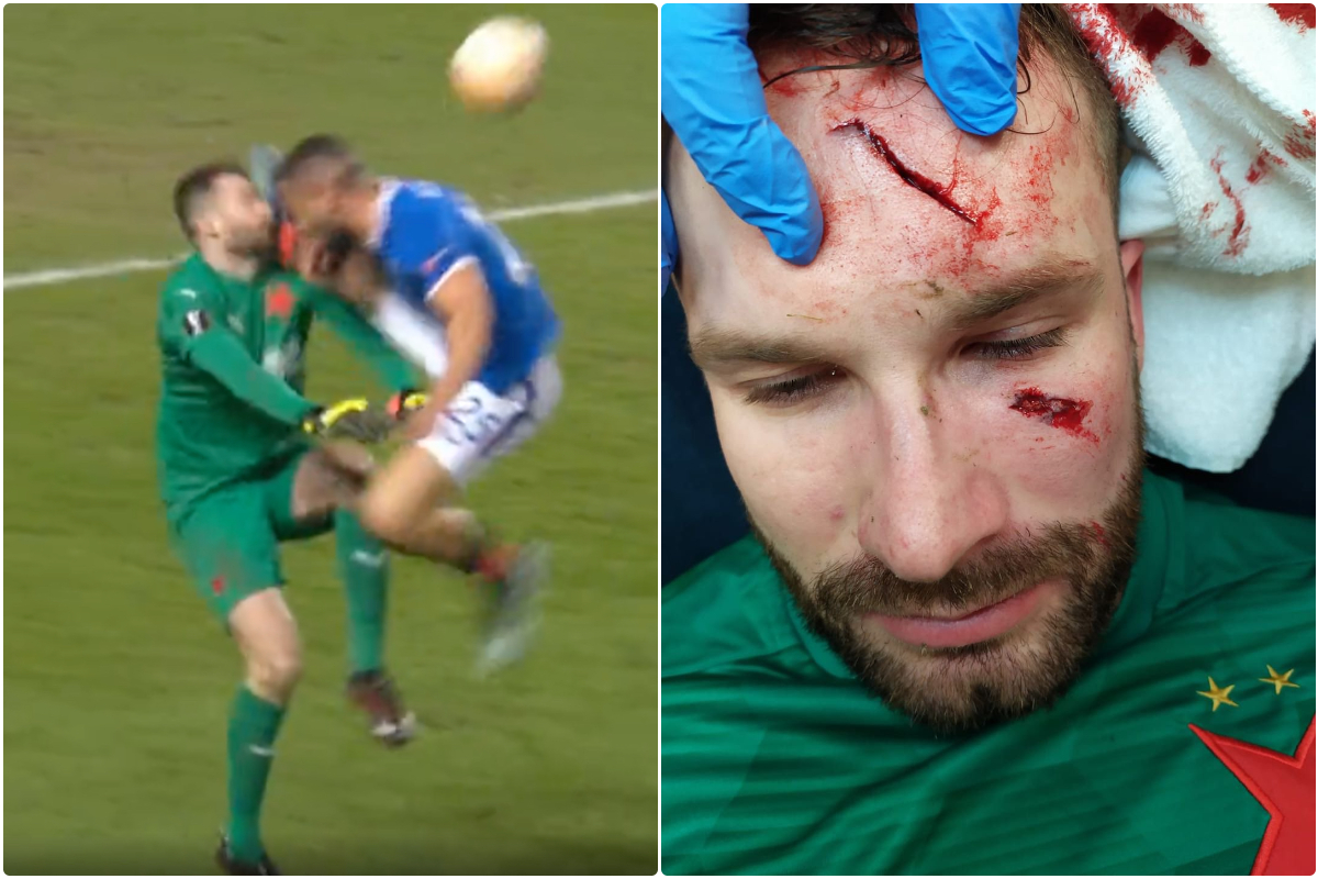 Slavia Prague keeper Kolar posts face after being kicked by Kemar Roofe
