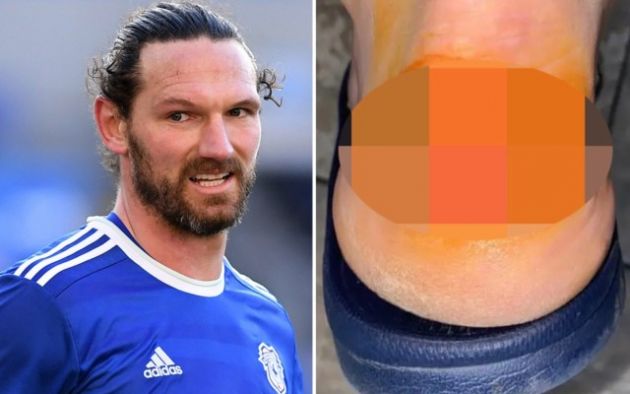 sean morrison horror injury