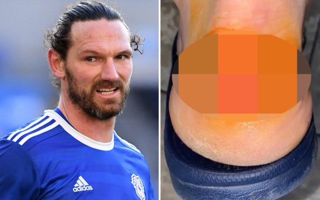sean morrison horror injury
