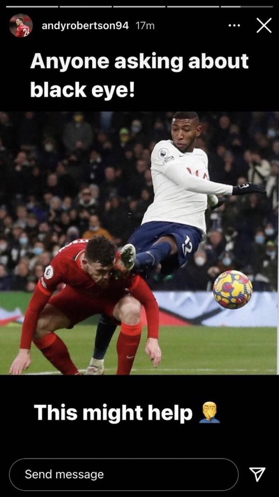 Andy Robertson shared a photo of Emerson Royal kicking his face Andy Robertson shared a photo of Emerson Royal kicking his face