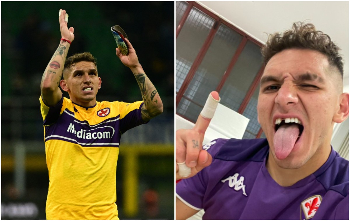 torreira tooth photos