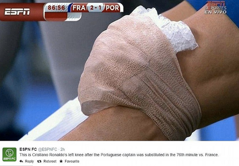 Cristiano Ronaldo's knee