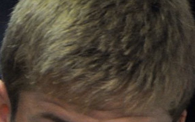 Eric Dier's hair