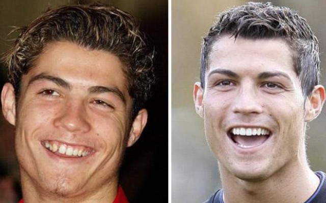 Cristiano Ronaldo then and now