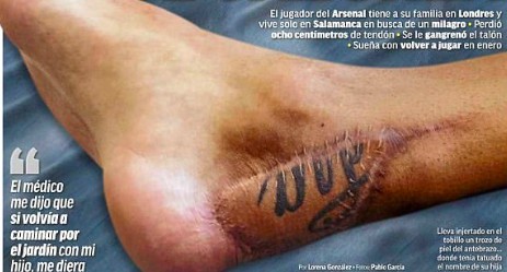 Cazorla's gruesome foot injury