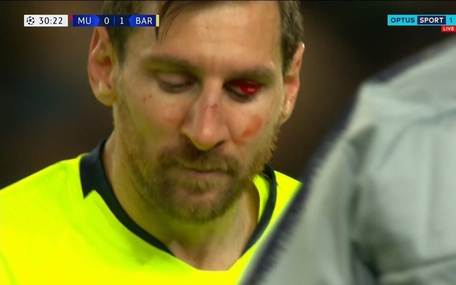Messi-bleeding-after-challenge-from-Smalling
