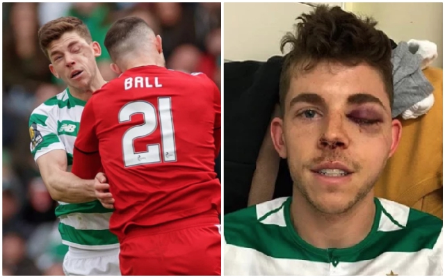 Ryan Christie Celtic face injury