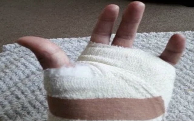 Football-accident