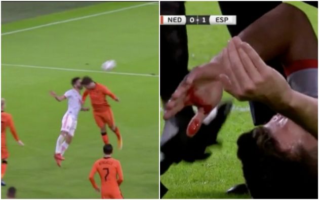 Video - Gaya left bleeding after head clash during Spain vs Holland