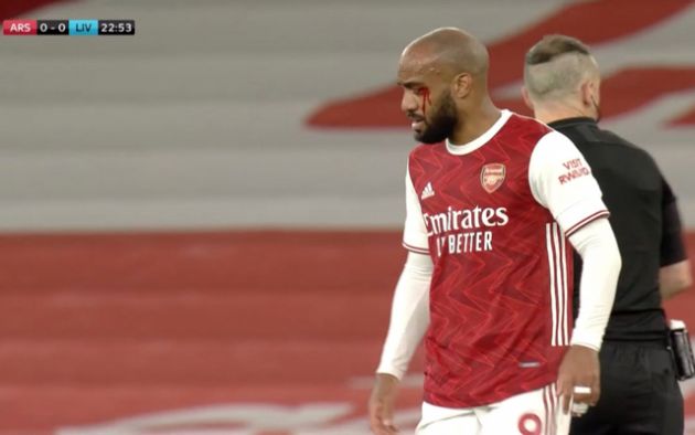 (Photo) Lacazette bleeds for Arsenal after clash with Liverpool ace Phillips