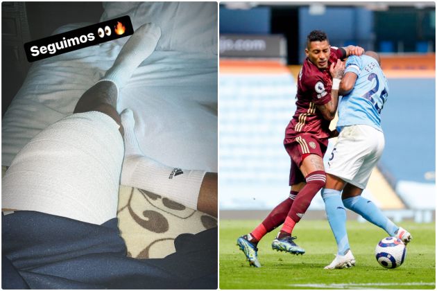 Raphinha feared he would lose leg after challenge from City star Fernandinho