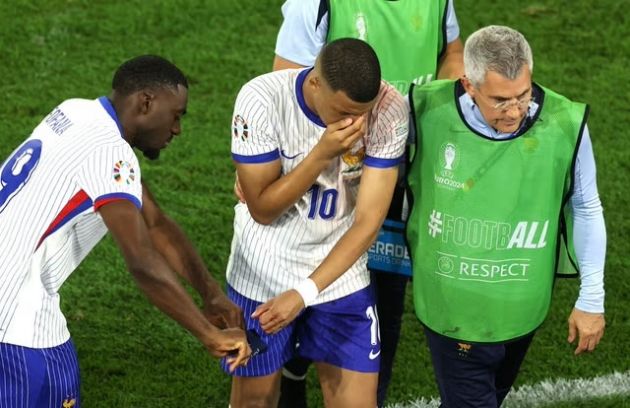 Kylian Mbappe leaves the pitch with a broken nose.